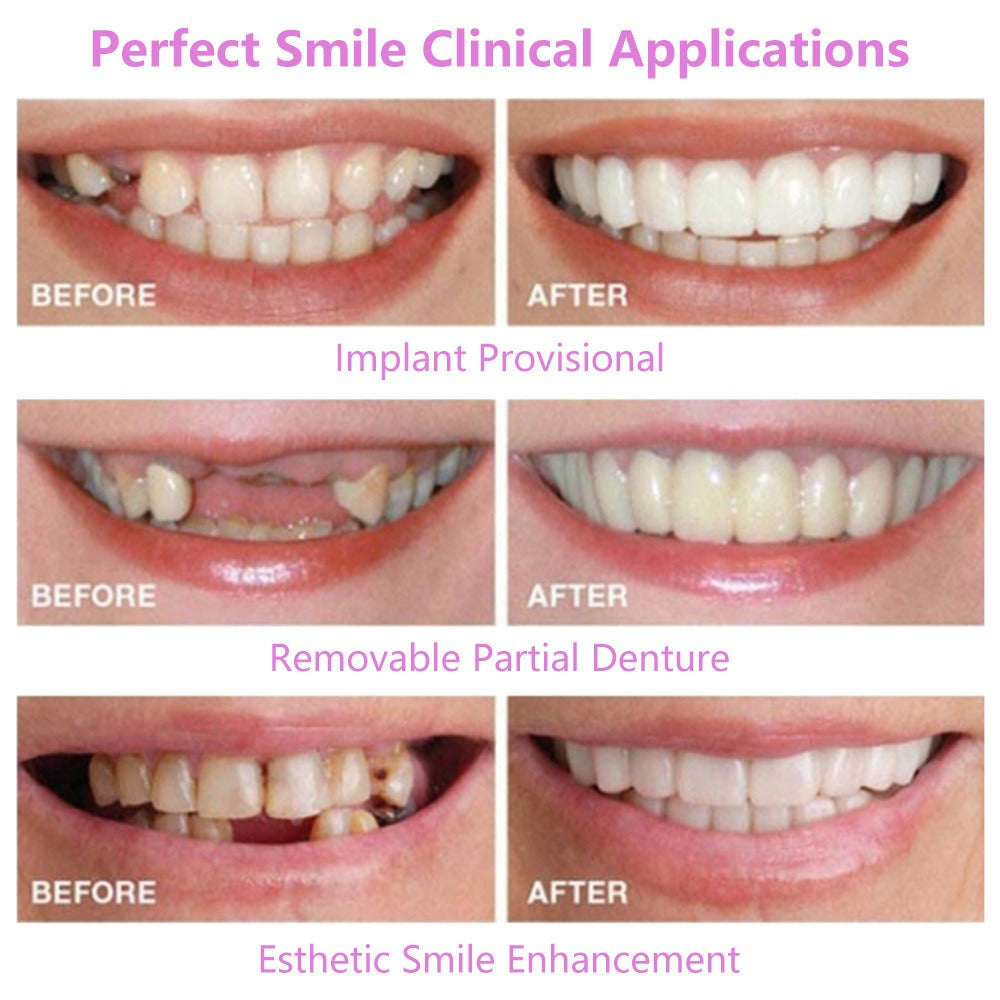 Simulation braces smile whitening sixth generation non-porous teeth set dentures